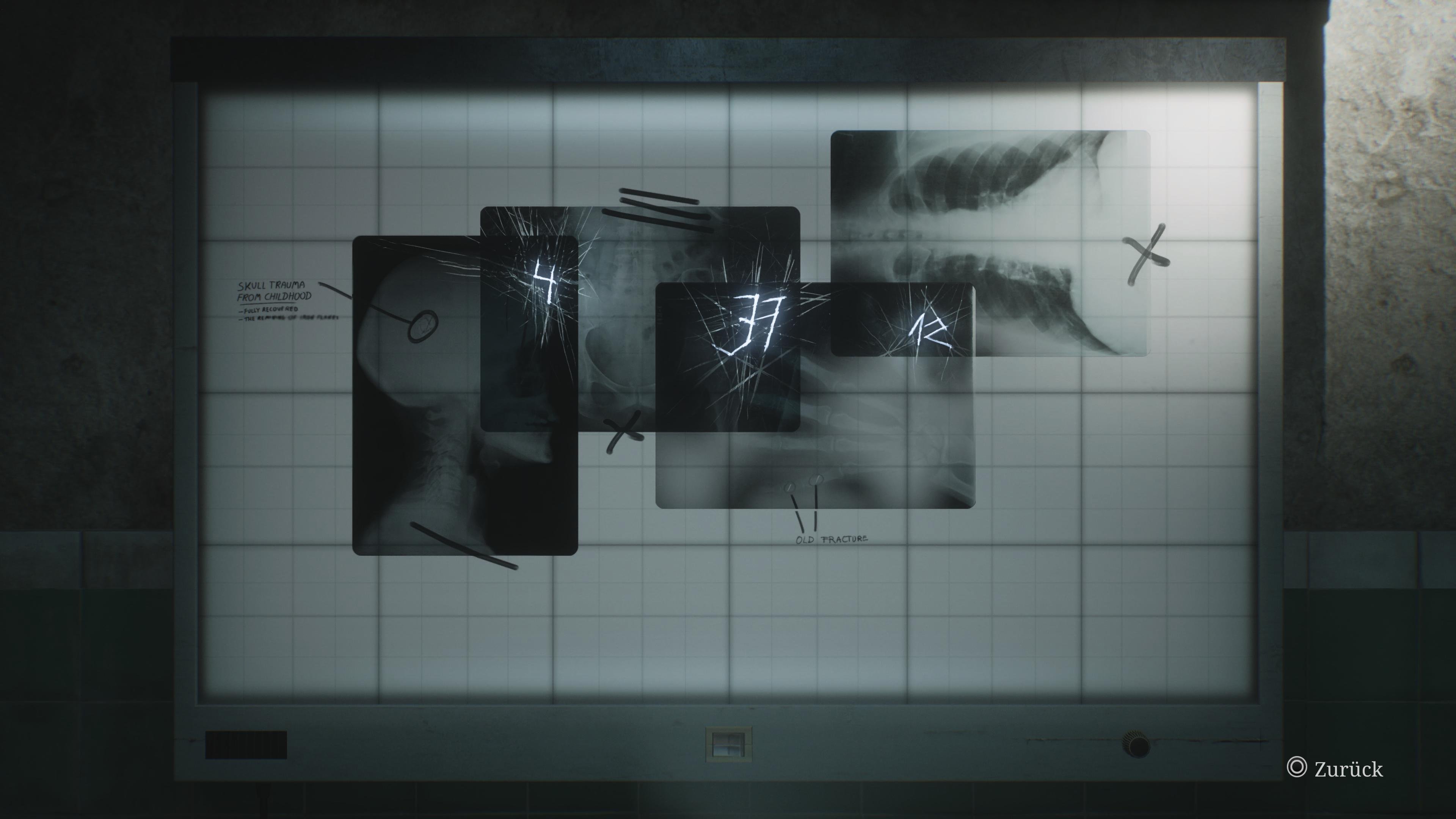 5 Millionen Mal verkauft: Silent Hill 2 Remake